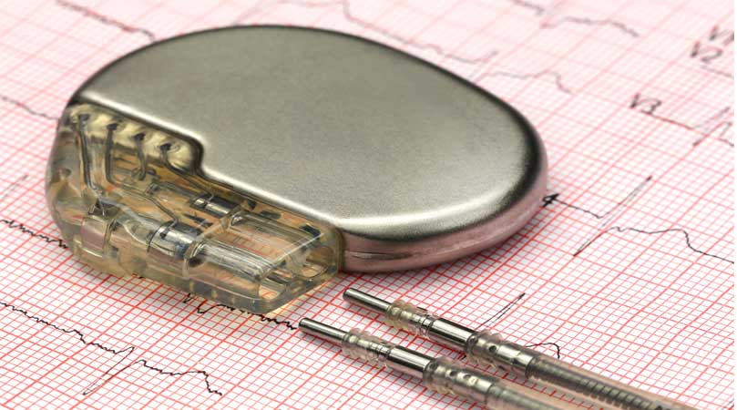 Pacemaker Implantation